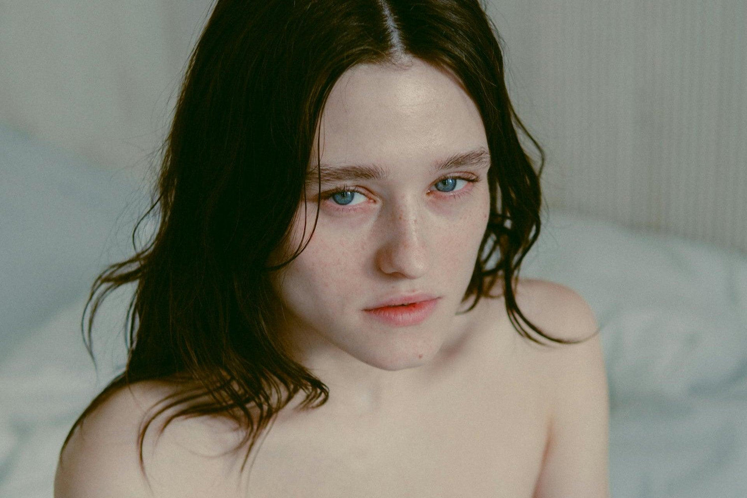 Cortisol Face: Understanding Causes, Symptoms, and Solutions